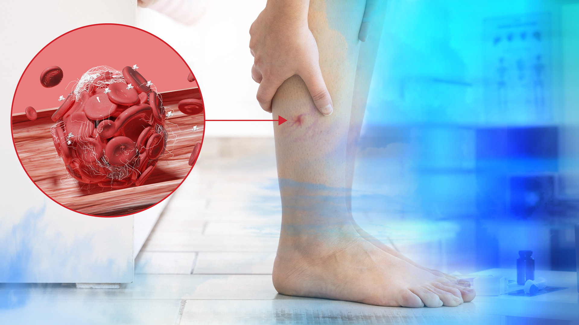 Флебология г. Ханты-Мансийск