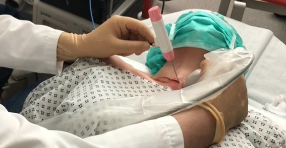 Удаление узла щитовидной железы г. Ханты-Мансийск